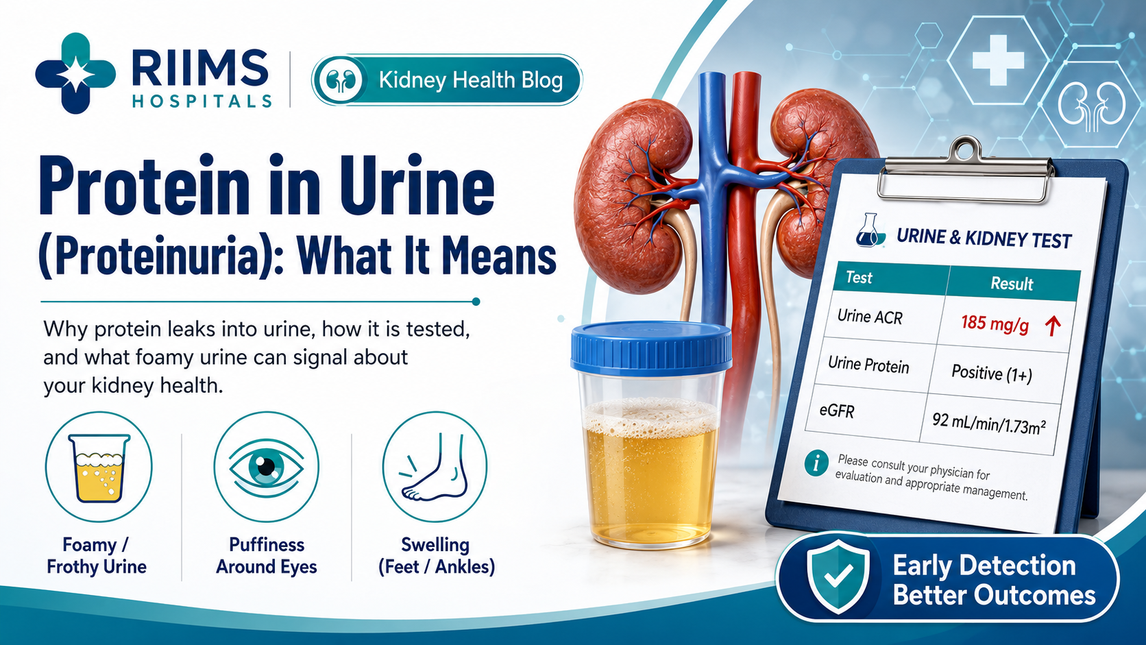 Protein in Urine (Proteinuria): What It Means